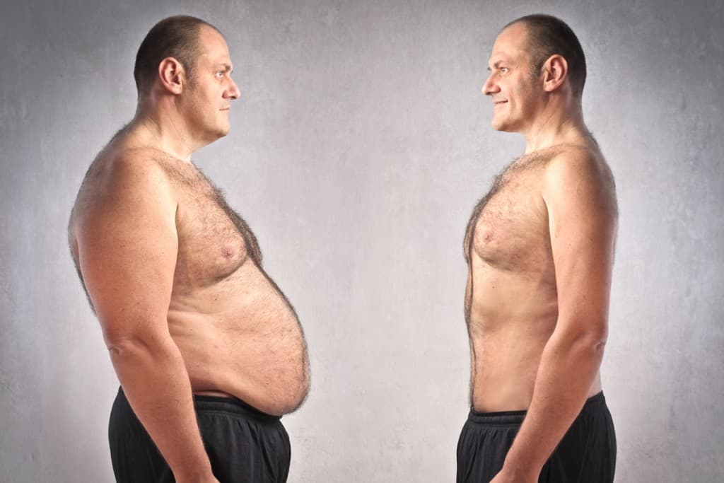 iStock_before-after-weight-loss