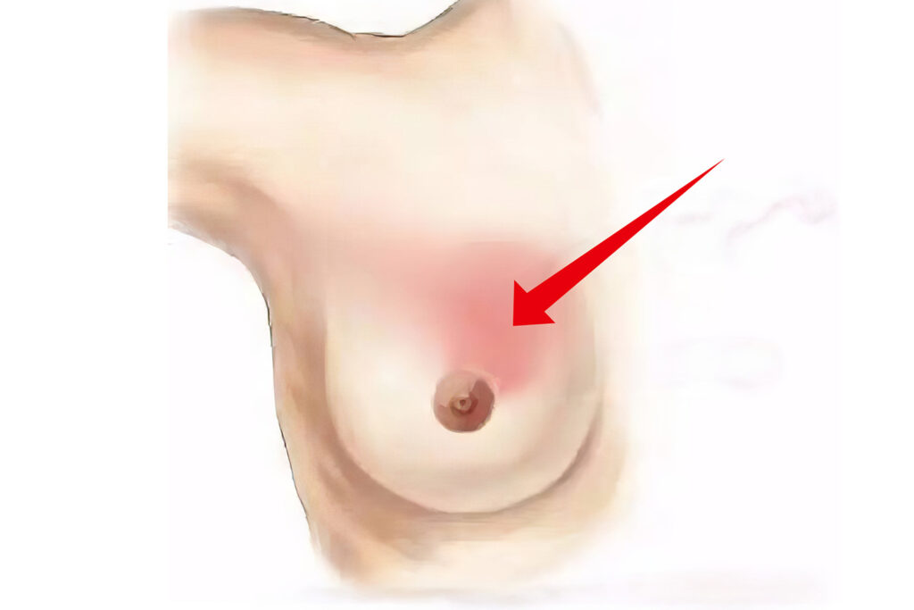 13 Warmth In The Breast