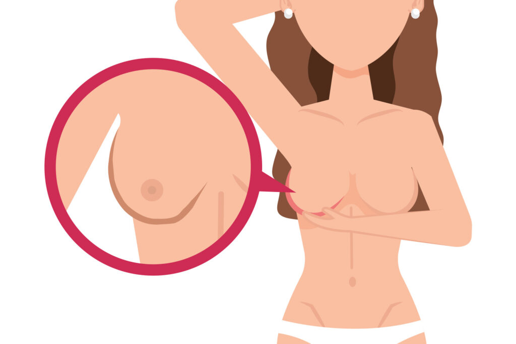 2 Changes In Breast Shape Or Size Freepik