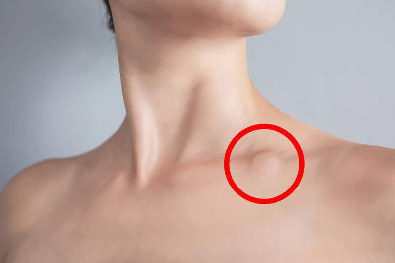 Early Signs Of Breast Cancer That Often Go Unnoticed Foodies Deli Early Signs Of Breast Cancer That Often Go Unnoticed Foodies Deli