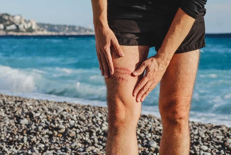 Shutterstock 2334282931 Jellyfis