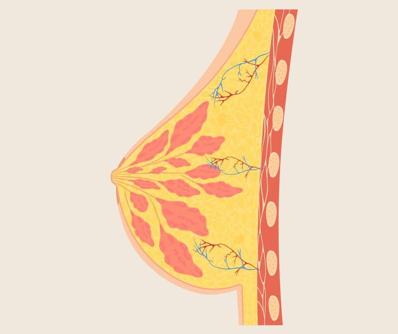 Thickening Of Breast Tissue