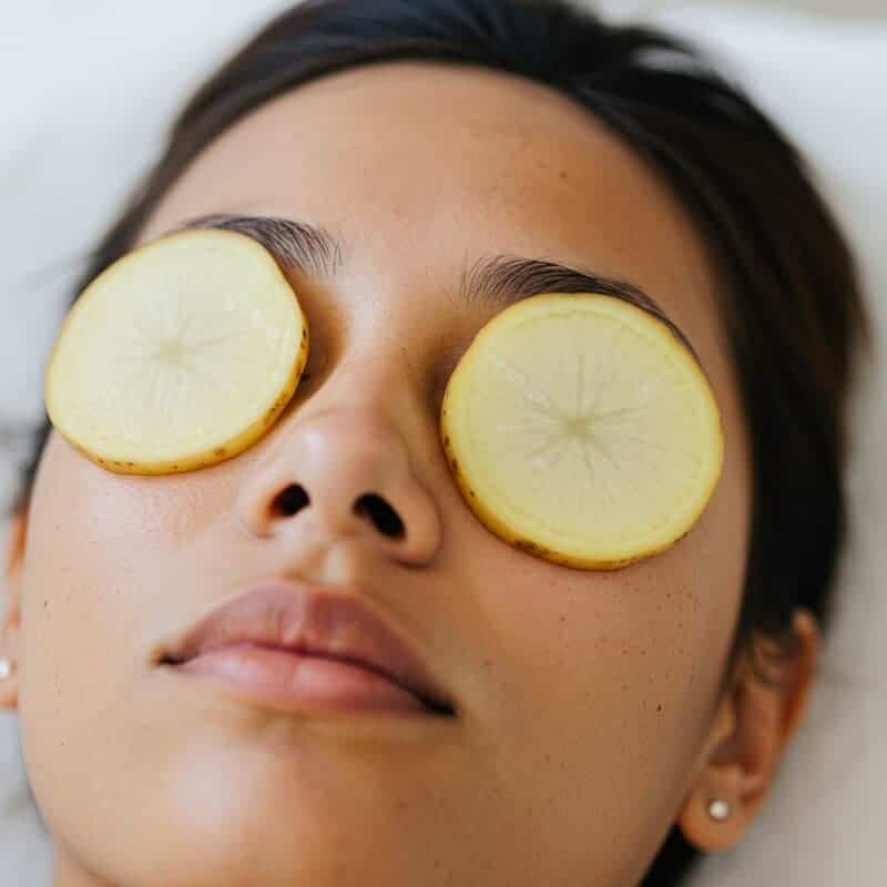 7. Raw Potato Slices for Eye Circles