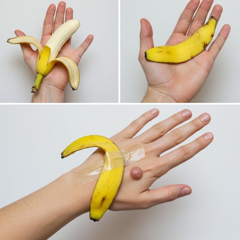 12. Banana Peels for Warts