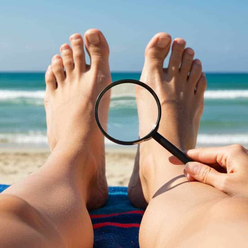 22. Sunbathing for Fungal Infections