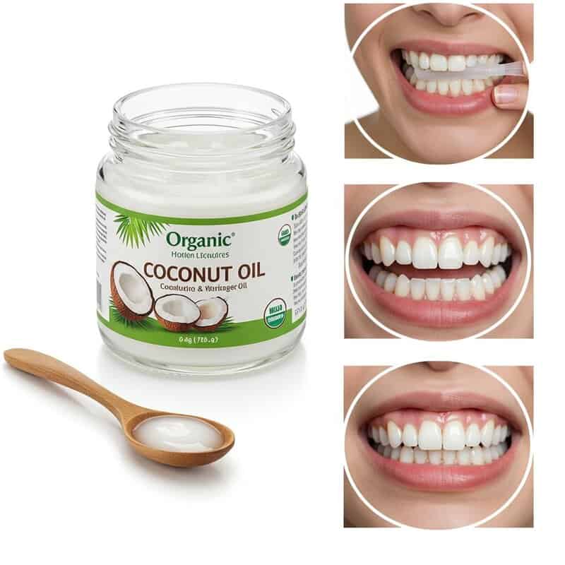 19. DIY Teeth Whitening