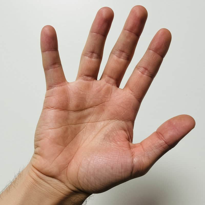 25. Darkening of Skin