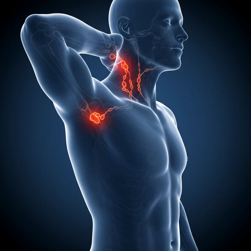 48. Swollen Lymph Nodes