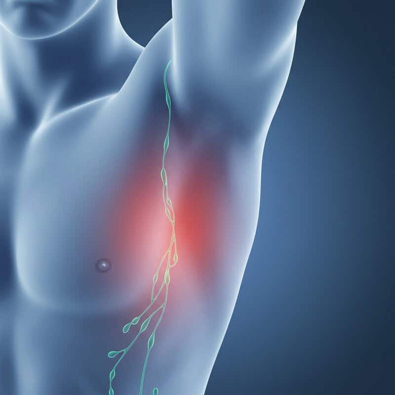 9. Swollen Lymph Nodes Under the Arm or Collarbone