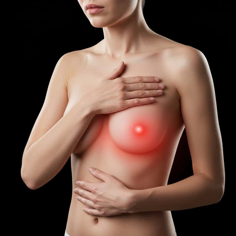 17. Burning Sensation in the Breast