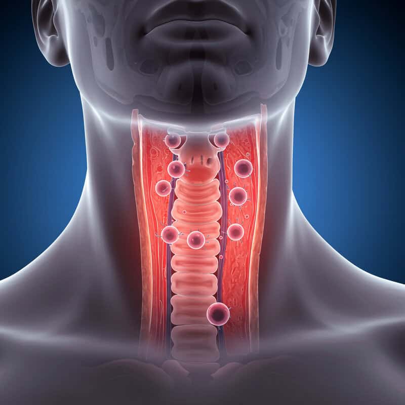 40. Difficulty Swallowing
