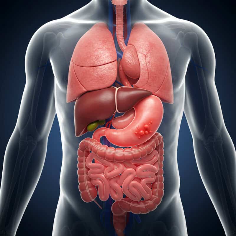44. Persistent Indigestion or Heartburn