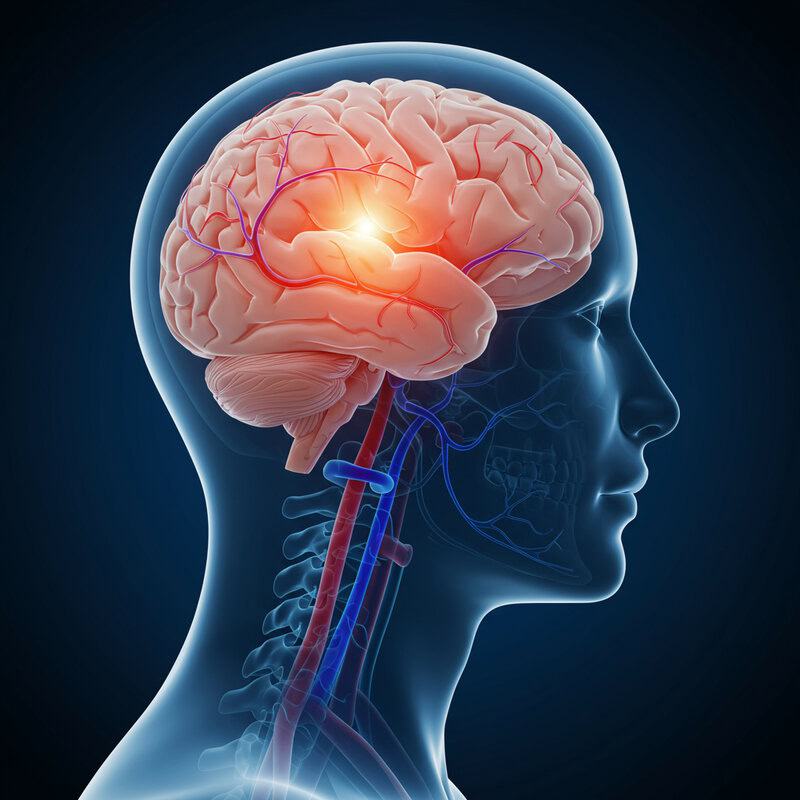 22. Sudden Severe Headache