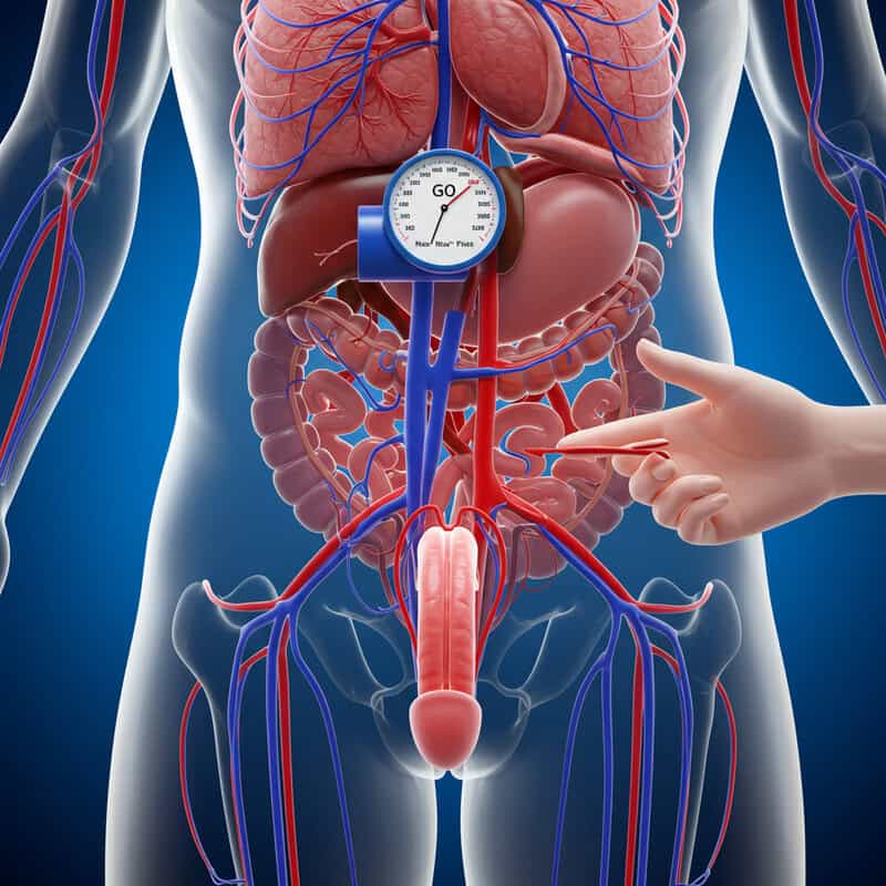 28. Erectile Dysfunction