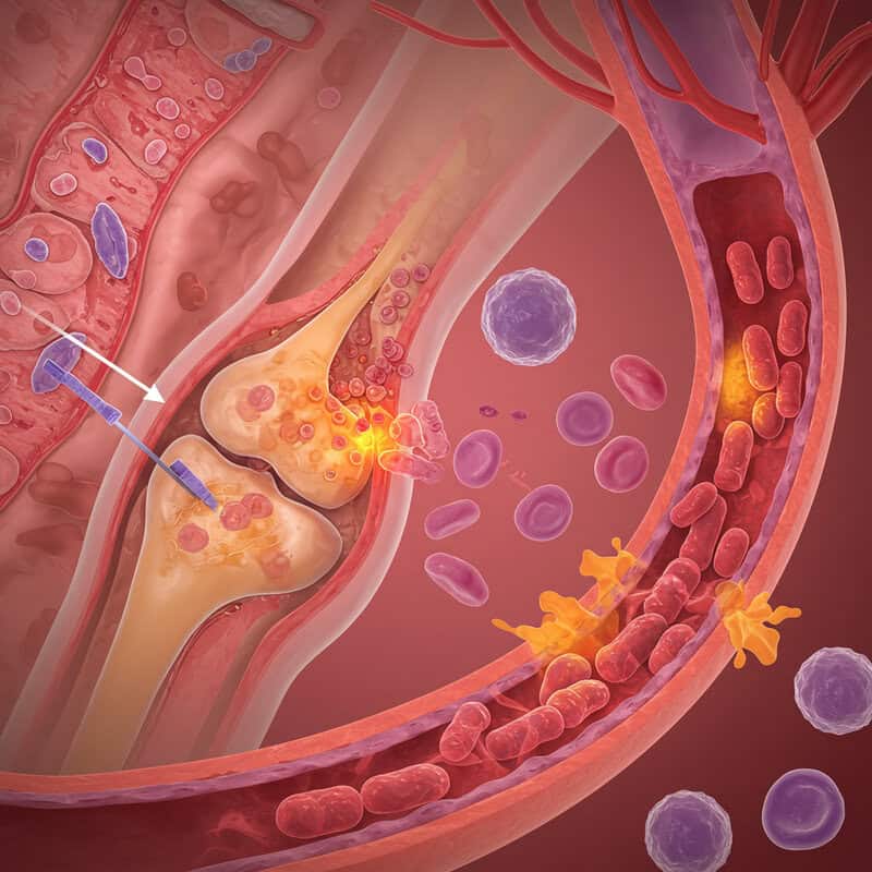 2. Autoimmune Attack and Blood Vessels