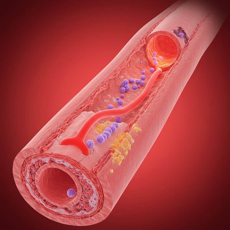 5. Endothelial Dysfunction