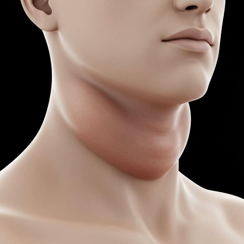 46. Swelling or Enlargement of the Neck