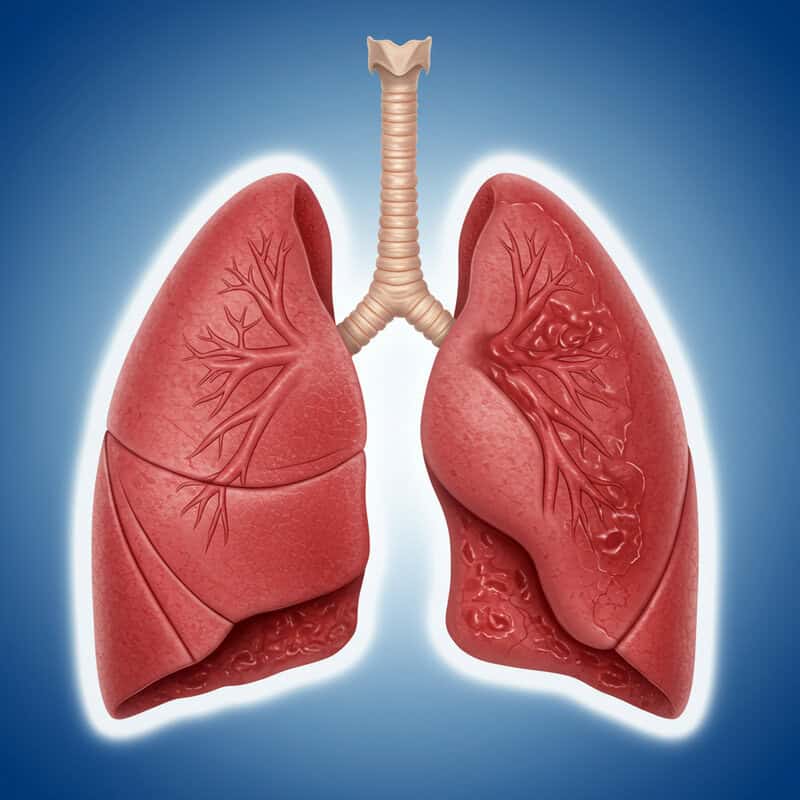23. Chronic Respiratory Infections